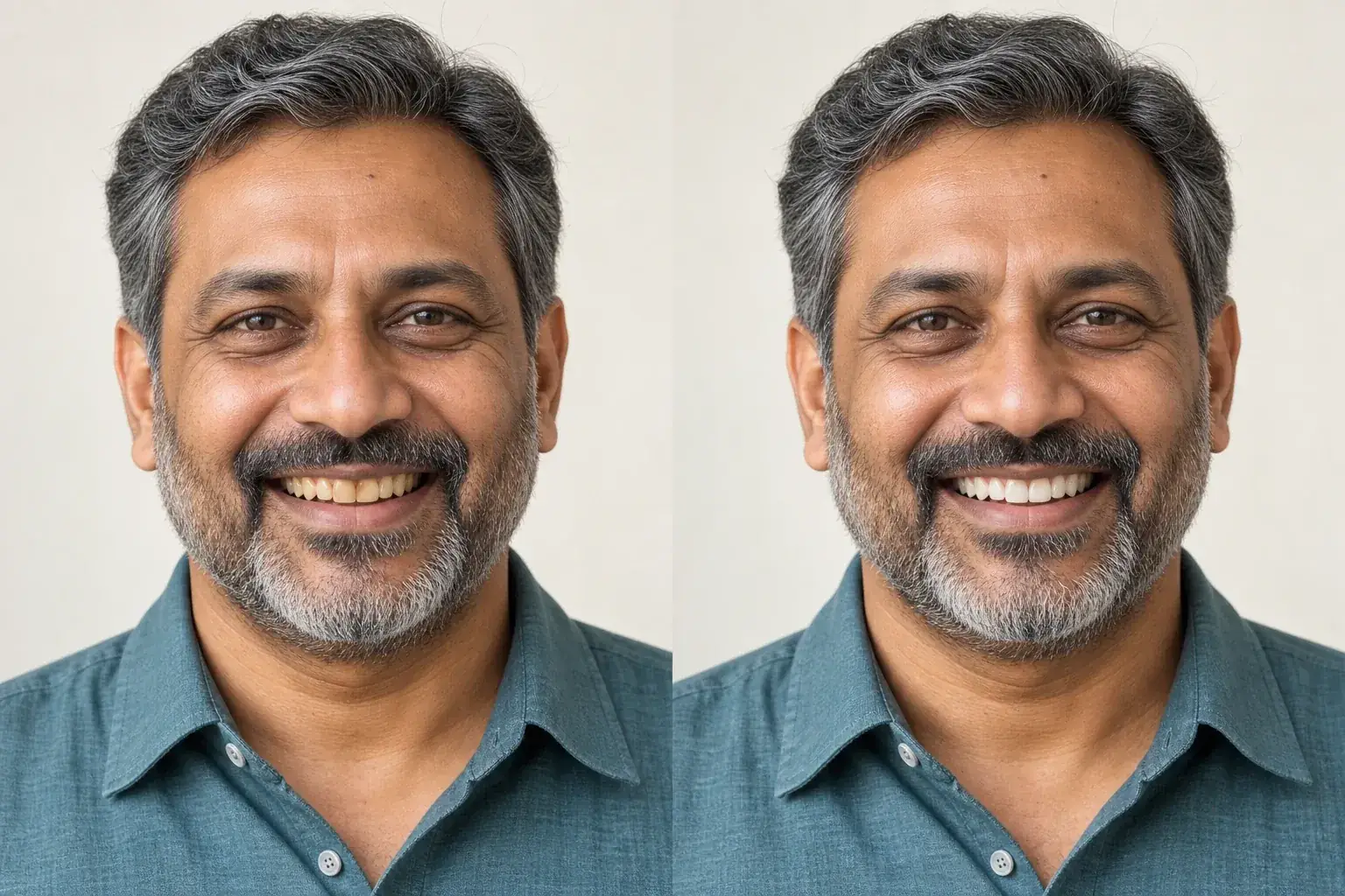 Side-by-side example of teeth naturally whitened and refined